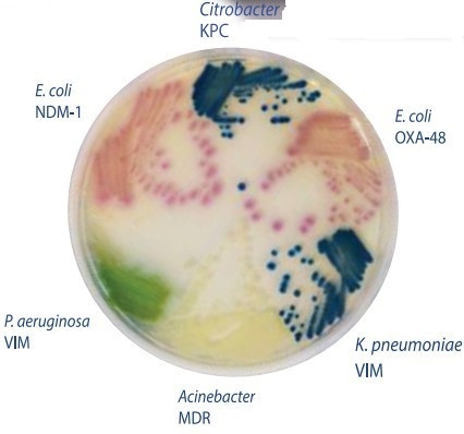 Hylabs碳青霉烯類耐藥腸桿菌(CRE)檢測瓊脂培養板